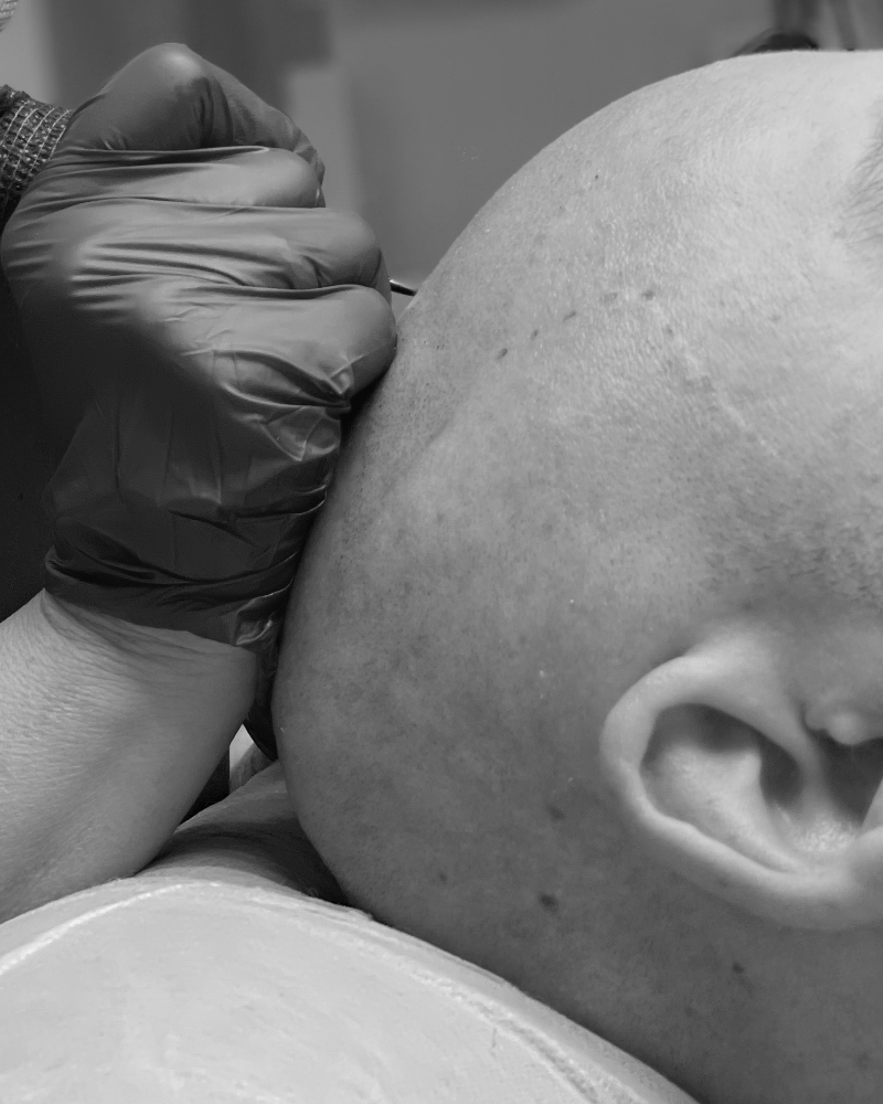 #micropigmentacion#micropigmentacionastuiras#micropigmentacioncapilar#micropigmentacioncejas#micropigmentacionlabios#tatuajereconstructivo#eliminaciondetatuajes