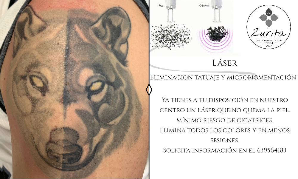 #micropigmentacion#micropigmentacionastuiras#micropigmentacioncapilar#micropigmentacioncejas#micropigmentacionlabios#tatuajereconstructivo#eliminaciondetatuajes