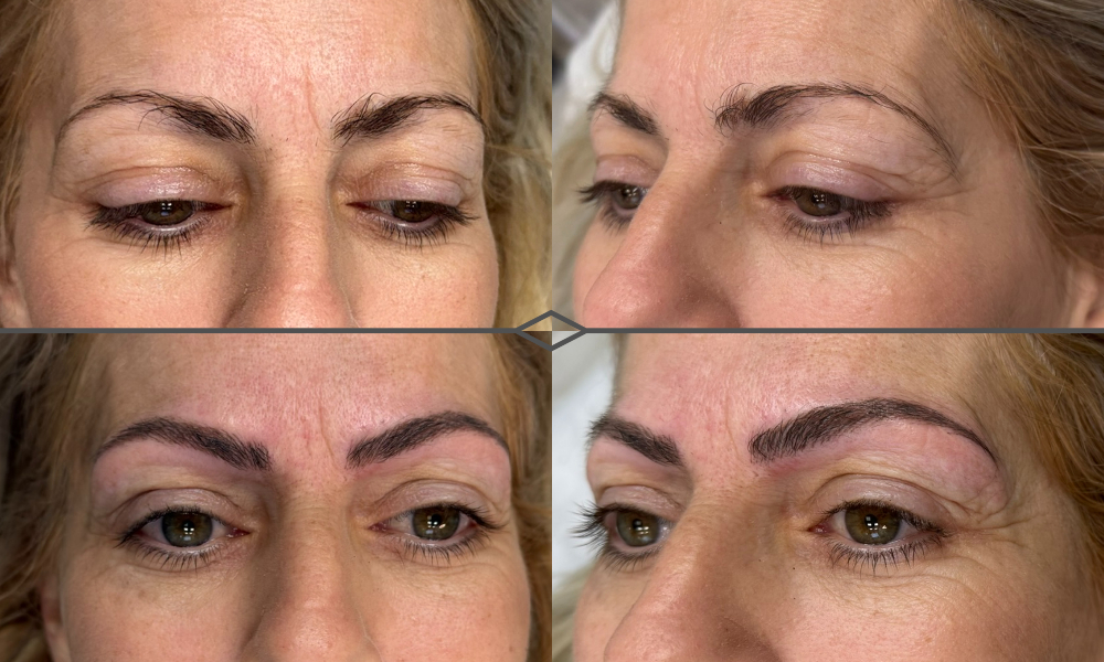 #micropigmentacion#micropigmentacionastuiras#micropigmentacioncapilar#micropigmentacioncejas#micropigmentacionlabios#tatuajereconstructivo#eliminaciondetatuajes
